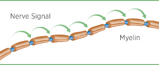 A healthy nerve with a complete myelin layer A healthy nerve with a complete myelin layer